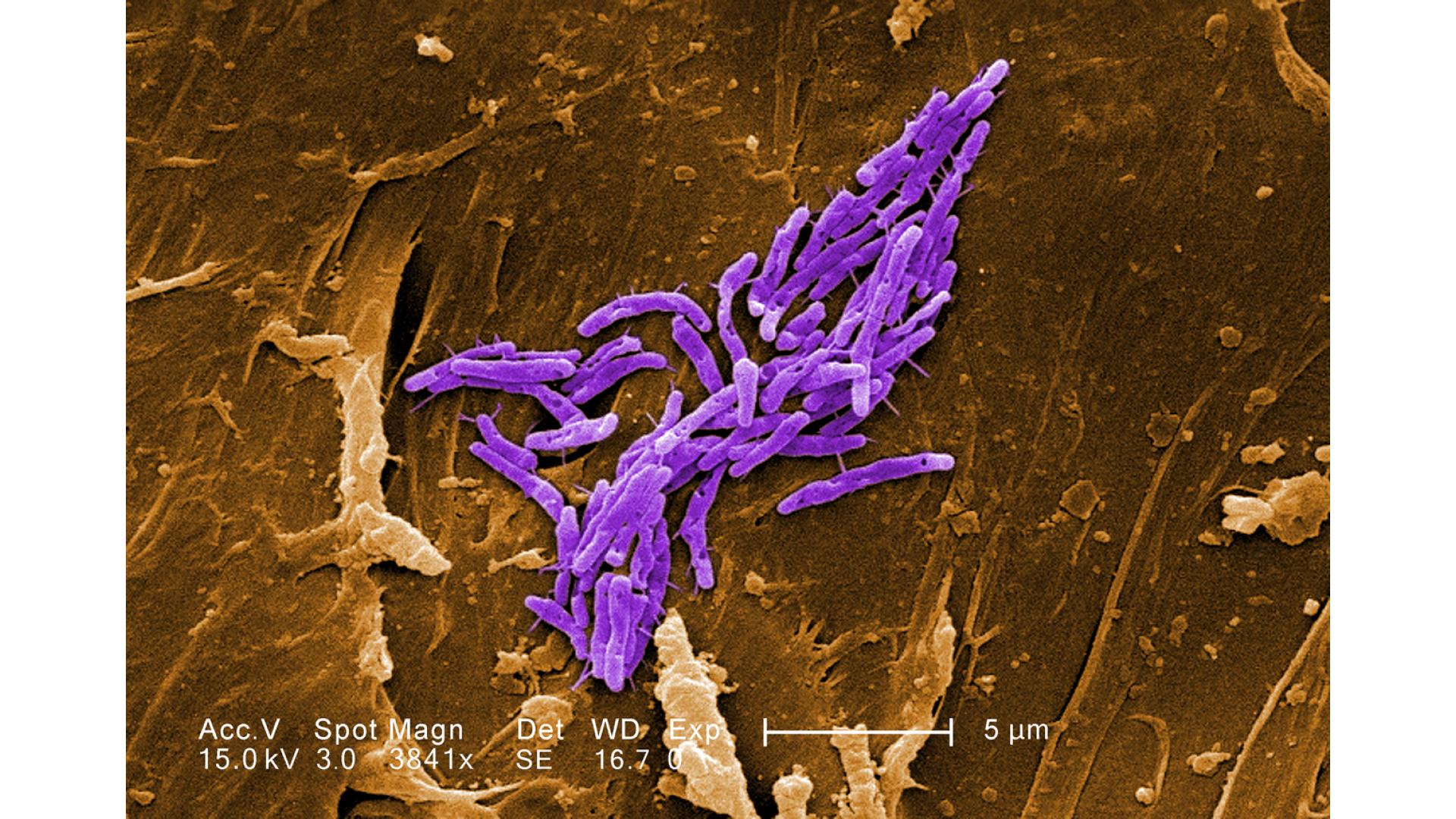https://www.noraq.com/new2/image/cache/catalog/d_blog_module/post/Mycobacterium_fortuitum-1920x1080.png