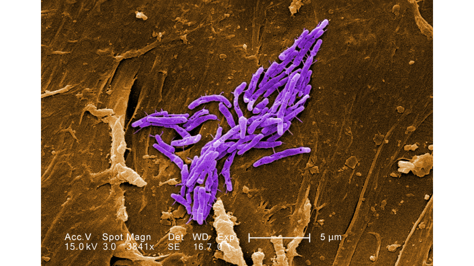 Fisketuberkulose (Mycobacterium marinum og M. fortuitum)